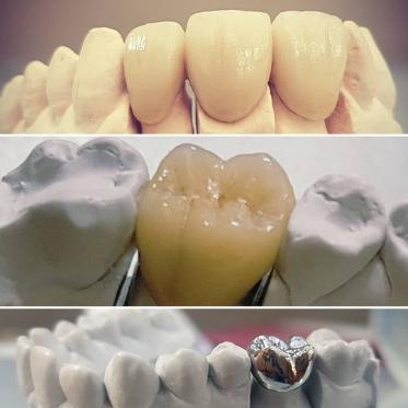 Crown and Bridge Perthshire